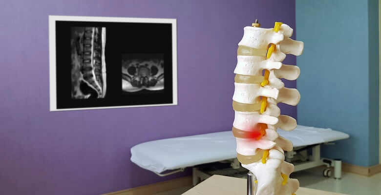 Minimal İnvaziv Dar Kanal Ameliyatı Güvenli mi? Olası Riskler ve Komplikasyonlar